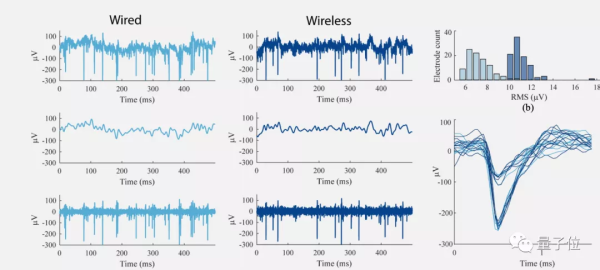 这年头连人用脑机接口信号都能无线传输了，瘫痪者可在家轻松上网